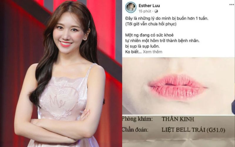 Hari Won chia sẻ việc bị liệt nửa mặt 7 Hari Won đăng ảnh nửa khuôn mặt cùng giấy khám sức khỏe.