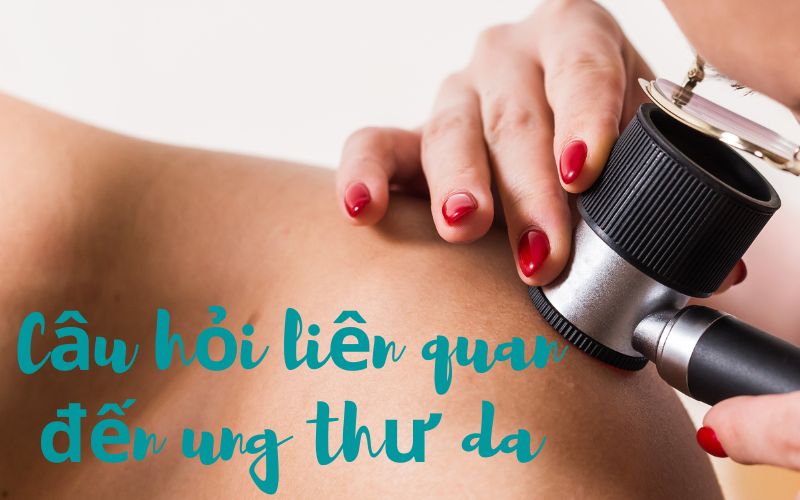 Tất tần tật câu hỏi về bệnh ung thư da nên hỏi bác sĩ ngay 7 bệnh ung thư da