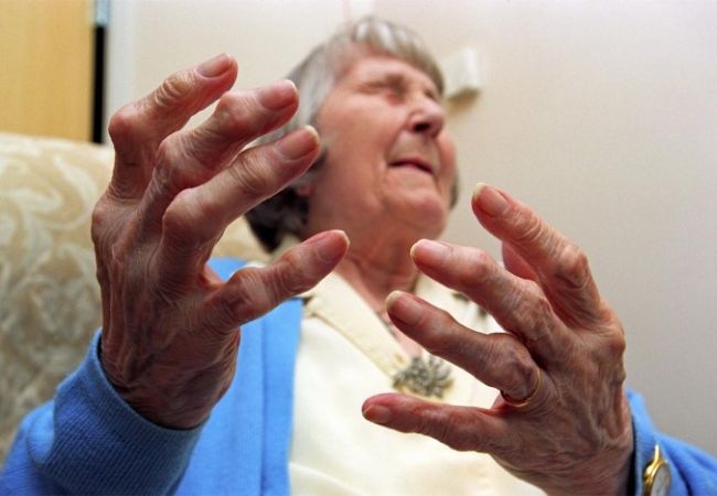 tác hại bẻ khớp ngón tay về già