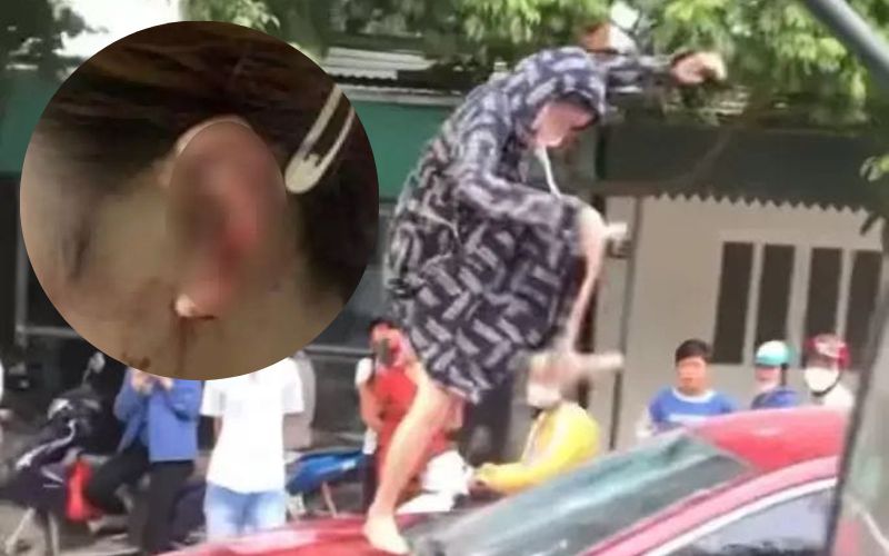 Công an vào cuộc vụ đánh ghen khiến cô gái đứt tai tại Thanh Hóa 6 Công an vào cuộc vụ đánh ghen khiến cô gái đứt tai tại Thanh Hóa