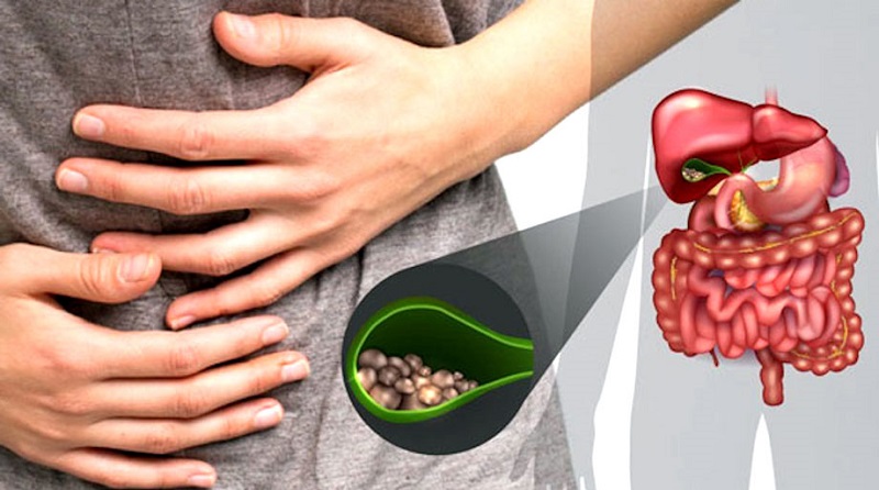 Nước ngọt điều trị sỏi dạ dày tốt cho sức khỏe 6 uống nước ngọt trị sỏi dạ dày