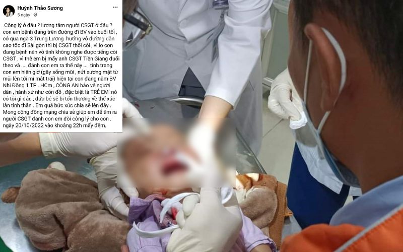 Xác minh làm rõ CSGT đánh em bé 3 tuổi gãy sống mũi ở Tiền Giang