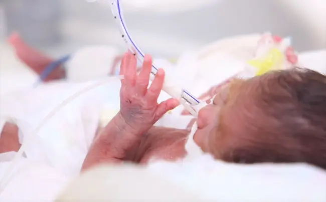 Bệnh viện đã cứu sống bé sinh non ngừng tim