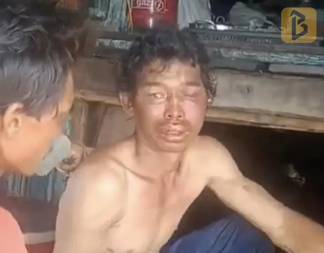 Xác định 3 nghi can hành hạ dã man 2 người đàn ông trên tàu cá 7 Một trong 2 nạn nhân trong vụ hành hung trên tàu cá
